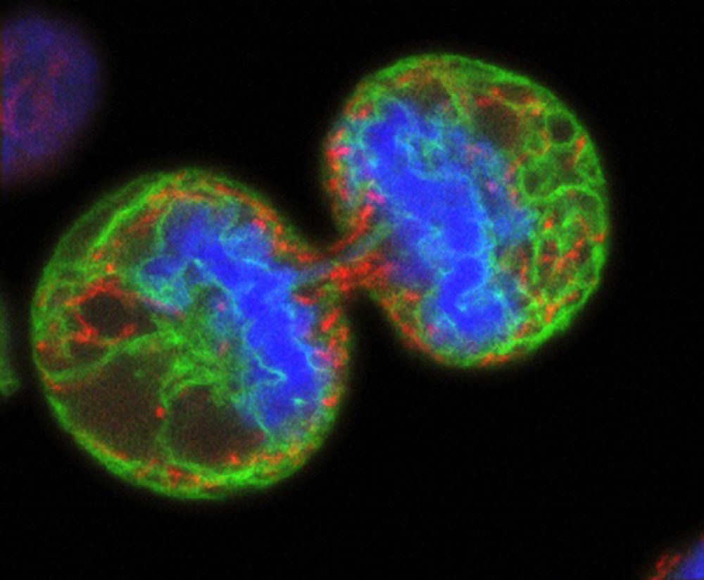 A dividing melanoma cell. Foundation spending matches or surpasses that of governments in fields such as cancer and genome research. Credit: Wellcome Trust.